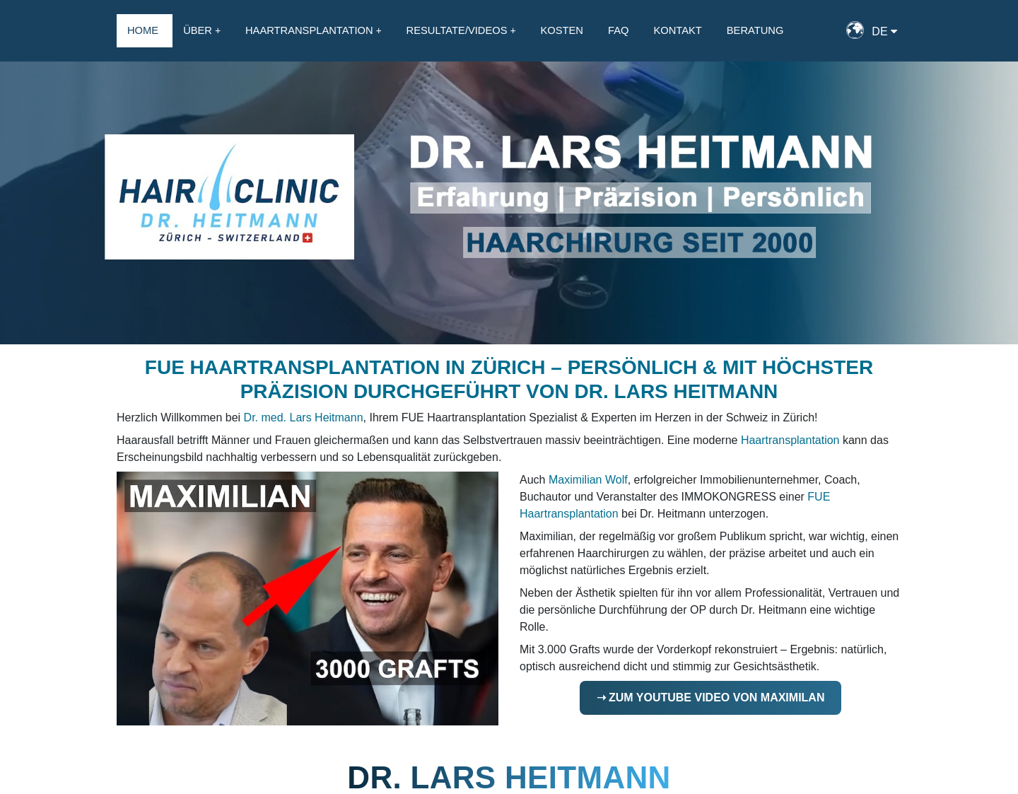 Aktuelle Website-Vorschau von Haarverpflanzungen in Zürich