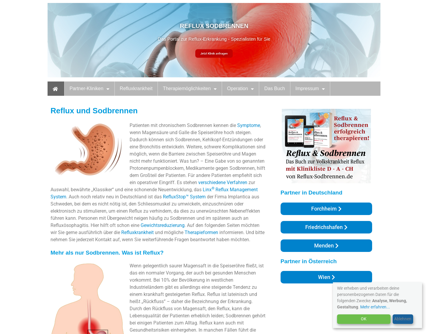 Aktuelle Website-Vorschau von Reflux-Sodbrennen - Beratung und Operation